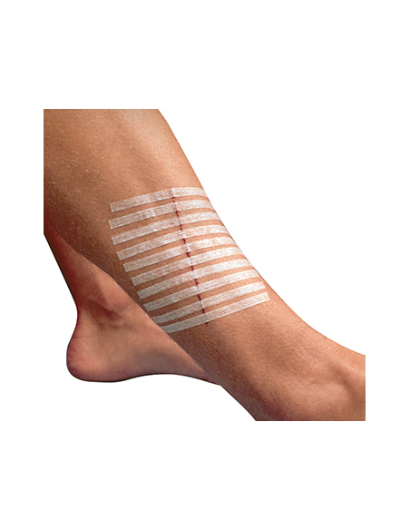 SUTURE STERI - STRIP 6X38MM X6